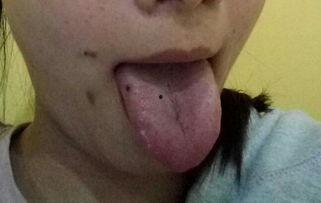 吃小白瓜舌头疼,揭秘为何舌头疼的秘密